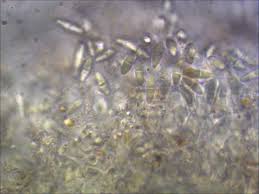 Attēlu rezultāti vaicājumam “Biatora sphaeroides”