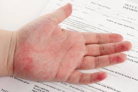 Image result for latex