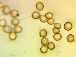 Attēlu rezultāti vaicājumam “Symphytocarpus impexus spores”