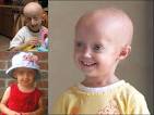 PROGERIA - DoctorsHangout.