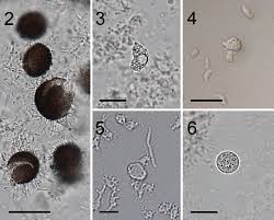 Attēlu rezultāti vaicājumam “Diderma umbilicatum plasmodium”