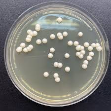Attēlu rezultāti vaicājumam “Comatricha fragilis spores”