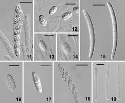 Attēlu rezultāti vaicājumam “Nectria sp., Neonectria sp.”