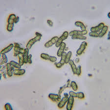 Attēlu rezultāti vaicājumam “Microcalicium disseminatum”