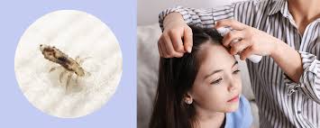 Attēlu rezultāti vaicājumam “Licea pusilla”