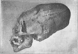 Image result for elongated skulls
