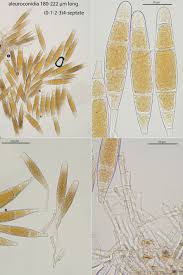Attēlu rezultāti vaicājumam “Bactridium flavum”