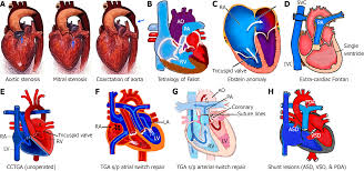 「ラブライナ・ワーズワース ワイルドアームズ クロスファイア」の画像検索結果