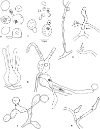 Attēlu rezultāti vaicājumam “Tremella encephala”