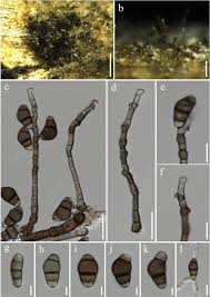 Attēlu rezultāti vaicājumam “Stemonitis foliicola spores”