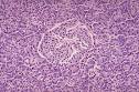 <b>Islotes pancreáticos</b>