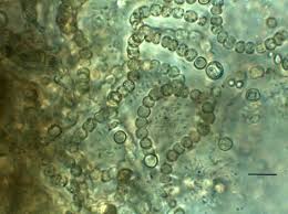 Attēlu rezultāti vaicājumam “Nostoc commune cells”