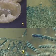 Attēlu rezultāti vaicājumam “Peziza repanda”