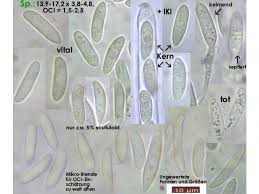 Attēlu rezultāti vaicājumam “Hymenoscyphus calyculus”