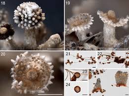 Attēlu rezultāti vaicājumam “Diachea muscorum spores”