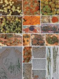 Attēlu rezultāti vaicājumam “Heterotrichia oerstedii (syn. Arcyria oerstedii) spores”