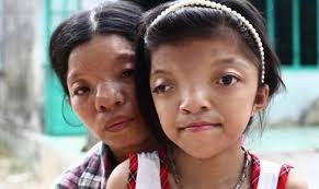 Image result for агент оранж