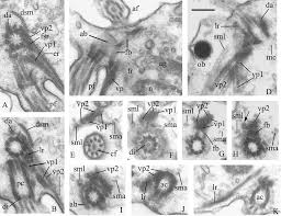 Attēlu rezultāti vaicājumam “Symphytocarpus impexus plasmodium”
