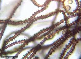 Attēlu rezultāti vaicājumam “Arcyria incarnata”