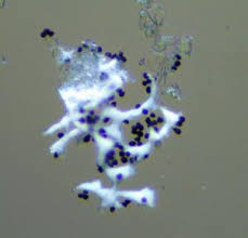 Attēlu rezultāti vaicājumam “Badhamia capsulifera var. arborea spores”