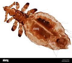 Attēlu rezultāti vaicājumam “Pediculus humanus capitis”