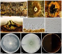 Attēlu rezultāti vaicājumam “Diachea dictyospora (syn. Craterium dictyosporum) spores”