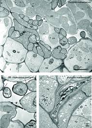 Attēlu rezultāti vaicājumam “Ochropsora ariae spores”