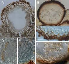 Attēlu rezultāti vaicājumam “Didymium verrucisporum spores”