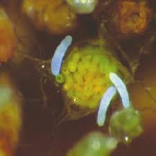 Attēlu rezultāti vaicājumam “Bryum pallens sporophyte”