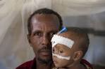 Somalia 2009 © Javier Roldan. A boy hugs his father following treatment by ... - 51025
