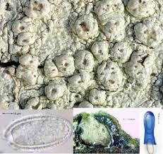 Attēlu rezultāti vaicājumam “Pertusaria leioplaca”