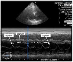 Image result for  ^ L V [ h    