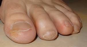 Znalezione obrazy dla zapytania palec