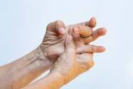 Trigger Finger: Causes, Symptoms, and Treatment Options ...