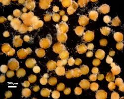 Attēlu rezultāti vaicājumam “Diderma globosum spores”