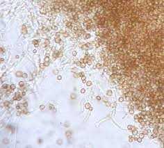 Attēlu rezultāti vaicājumam “Chaenotheca brunneola”