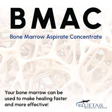 Image result for BMAC