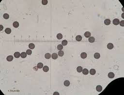 Attēlu rezultāti vaicājumam “Badhamia lilacina spores”