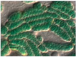 Attēlu rezultāti vaicājumam “Nostoc commune cells”