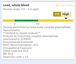 IRE 0.0 IRE 7.5에 대한 이미지 검색결과