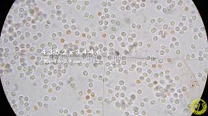 Attēlu rezultāti vaicājumam “Hyphodontia barba-jovis”