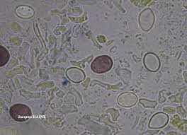Attēlu rezultāti vaicājumam “Lecanora conizaeoides”