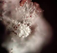 Attēlu rezultāti vaicājumam “Physarum bryocorticola macro”