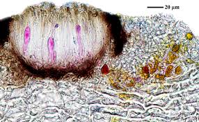 Attēlu rezultāti vaicājumam “Opegrapha rufescens”