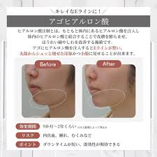 「カール・エドアルド・バイエルライン」の画像検索結果