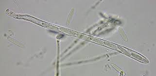 Attēlu rezultāti vaicājumam “Mitrula paludosa”