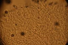 Attēlu rezultāti vaicājumam “Penicillium vulpinum”