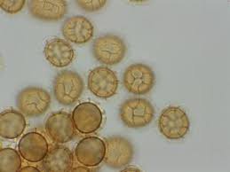 Attēlu rezultāti vaicājumam “Perichaena corticalis macro”