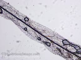 Attēlu rezultāti vaicājumam “Stemonaria irregularis spores”