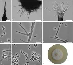 Attēlu rezultāti vaicājumam “Schistidium robustum sporophyte”